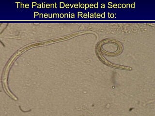 The Patient Developed a Second Pneumonia Related to:       