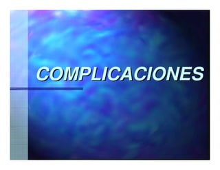 Sjögren Sindrome de