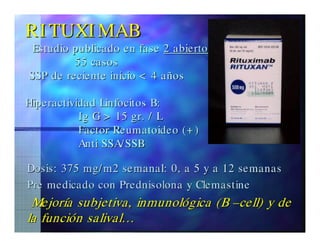 Sjögren Sindrome de