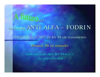 Sjögren Sindrome de