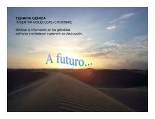 Sjögren Sindrome de