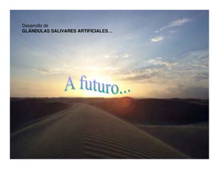 Sjögren Sindrome de