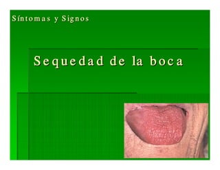 Sjögren Sindrome de