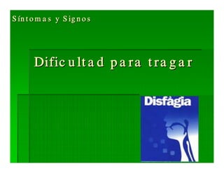 Sjögren Sindrome de