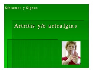 Sjögren Sindrome de