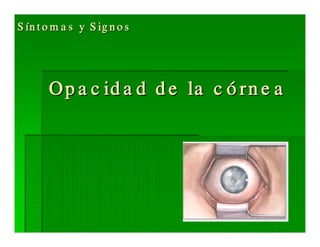 Sjögren Sindrome de