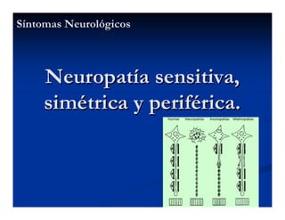 Sjögren Sindrome de