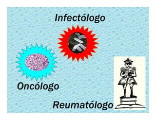Sjögren Sindrome de