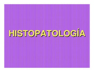 Sjögren Sindrome de