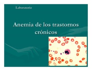 Sjögren Sindrome de