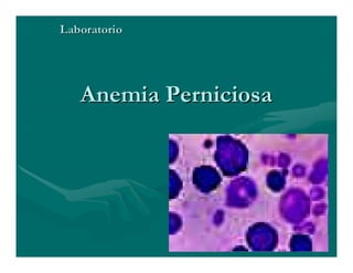 Sjögren Sindrome de