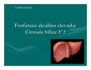 Sjögren Sindrome de