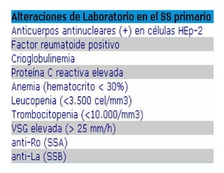 Sjögren Sindrome de