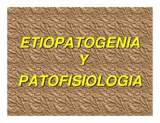 Sjögren Sindrome de