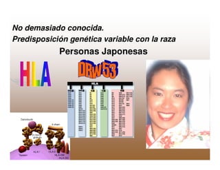 Sjögren Sindrome de