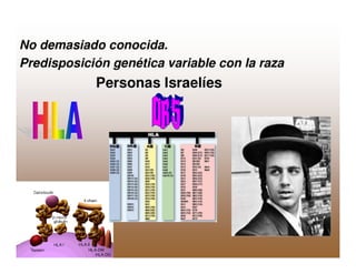 Sjögren Sindrome de