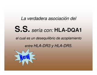 Sjögren Sindrome de