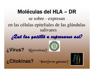 Sjögren Sindrome de