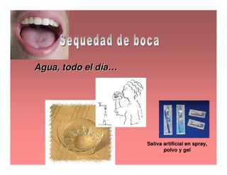 Sjögren Sindrome de