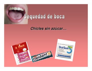 Sjögren Sindrome de