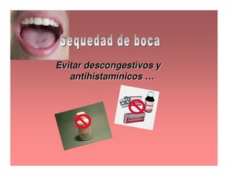 Sjögren Sindrome de