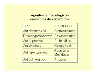 Sjögren Sindrome de