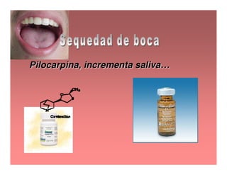 Sjögren Sindrome de