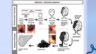screening colon, early detection of colon polyps.pptx