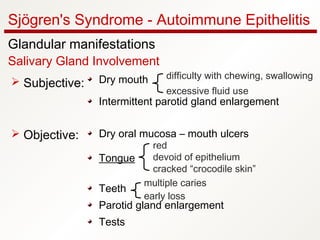 Sjögren's Syndrome - Autoimmune Epithelitis
Glandular manifestations
Salivary Gland Involvement
Dry mouth
Intermittent parotid gland enlargement
Dry oral mucosa – mouth ulcers
Tongue
Teeth
Parotid gland enlargement
Tests
 Subjective:
 Objective:
difficulty with chewing, swallowing
excessive fluid use
red
devoid of epithelium
cracked “crocodile skin”
multiple caries
early loss
 
