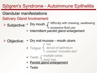 Sjögren's Syndrome - Autoimmune Epithelitis
Glandular manifestations
Salivary Gland Involvement
Dry mouth
Intermittent parotid gland enlargement
Dry oral mucosa – mouth ulcers
Tongue
Teeth
Parotid gland enlargement
Tests
 Subjective:
 Objective:
difficulty with chewing, swallowing
excessive fluid use
red
devoid of epithelium
cracked “crocodile skin”
multiple caries
early loss
 
