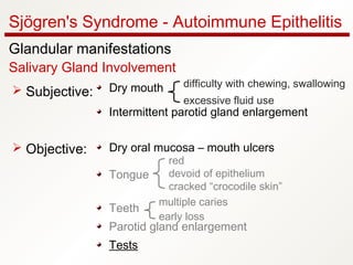 Sjögren's Syndrome - Autoimmune Epithelitis
Glandular manifestations
Salivary Gland Involvement
Dry mouth
Intermittent parotid gland enlargement
Dry oral mucosa – mouth ulcers
Tongue
Teeth
Parotid gland enlargement
Tests
 Subjective:
 Objective:
difficulty with chewing, swallowing
excessive fluid use
red
devoid of epithelium
cracked “crocodile skin”
multiple caries
early loss
 