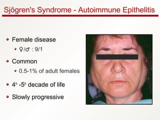 Sjögren's Syndrome - Autoimmune Epithelitis
Female disease
♀/♂ : 9/1
Common
0.5-1% of adult females
4th
-5th
decade of life
Slowly progressive
 