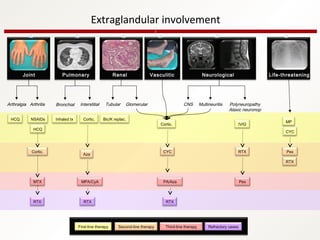 Joint Pulmonary Renal Vasculitic Neurological Life-threatening
Arthralgia Arthritis Bronchial Interstitial Tubular Glomerular CNS Multineuritis Polyneuropathy
Ataxic neuronop
HCQ NSAIDs
HCQ
Cortic.
MTX
RTX
Inhaled tx Cortic.
Aza
MPA/CyA
RTX
Bic/K replac.
Cortic.
CYC
PA/Aza
RTX
IVIG
RTX
MP
CYC
Pex
RTX
First-line therapy Second-line therapy Third-line therapy Refractory cases
Pex
Extraglandular involvement
 