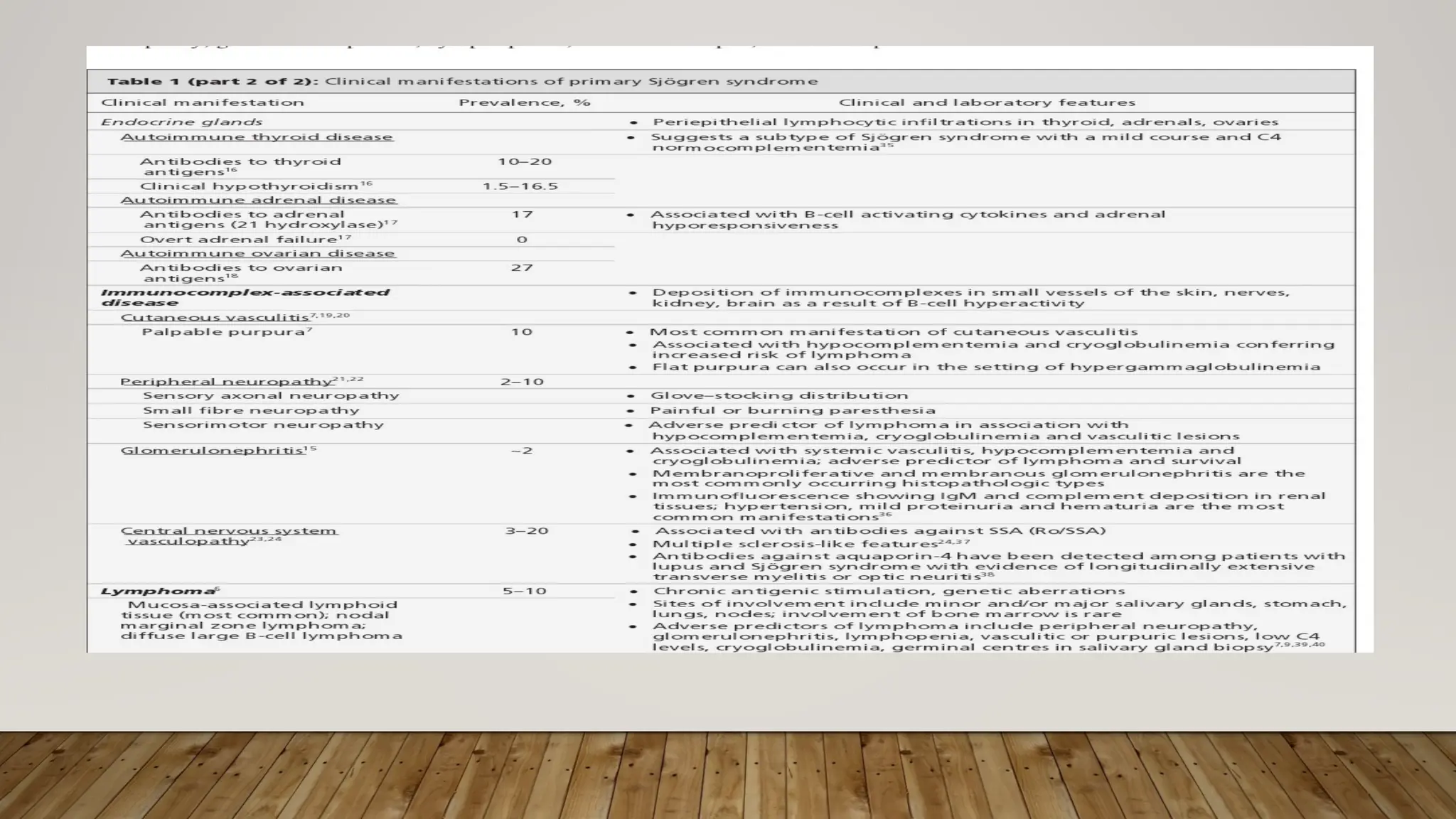 Sjogren S Syndrome Diagnosis And Treatment Ppt