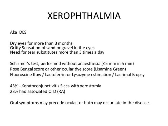 Sjogren syndrome by aseem