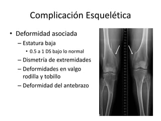 Complicación Esquelética
• Deformidad asociada
– Estatura baja
• 0.5 a 1 DS bajo lo normal
– Dismetría de extremidades
– Deformidades en valgo
rodilla y tobillo
– Deformidad del antebrazo
 