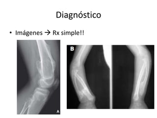 Diagnóstico
• Imágenes  Rx simple!!
 