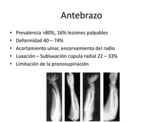 Antebrazo
• Prevalencia >80%, 16% lesiones palpables
• Deformidad 40 – 74%
• Acortamiento ulnar, encorvamiento del radio
• Luxación – Subluxación cúpula radial 22 – 33%
• Limitación de la pronosupinación
 