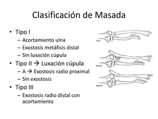 Clasificación de Masada
• Tipo I
– Acortamiento ulna
– Exostosis metáfisis distal
– Sin luxación cúpula
• Tipo II  Luxación cúpula
– A  Exostosis radio proximal
– Sin exostosis
• Tipo III
– Exostosis radio distal con
acortamiento
 