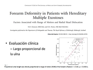 • Evaluación clínica
– Largo proporcional de
la ulna
 