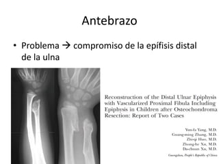 Antebrazo
• Problema  compromiso de la epífisis distal
de la ulna
 