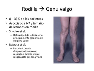 Rodilla  Genu valgo
• 8 – 33% de los pacientes
• Asocciado a Nº y tamaño
de lesiones en rodilla
• Shapiro et al.
– Deformidad de la tibia sería
principalmente responsable
del genu valgo
• Nawata et al.
– Perone acortado
desproporcionado con
respecto a la tibia sería el
responsable del genu valgo
 