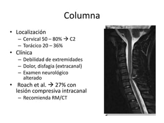 Columna
• Localización
– Cervical 50 – 80%  C2
– Torácico 20 – 36%
• Clínica
– Debilidad de extremidades
– Dolor, disfagia (extracanal)
– Examen neurológico
alterado
• Roach et al.  27% con
lesión compresiva intracanal
– Recomienda RM/CT
 