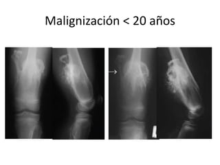 Malignización < 20 años
 