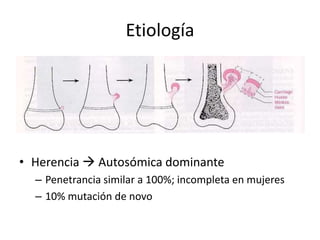 Etiología
• +
• Herencia  Autosómica dominante
– Penetrancia similar a 100%; incompleta en mujeres
– 10% mutación de novo
 