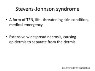 Stevens-Johnson syndrome
• A form of TEN, life- threatening skin condition,
medical emergency.
• Extensive widespread necrosis, causing
epidermis to separate from the dermis.
By: Arravindh Vivekananthan
 