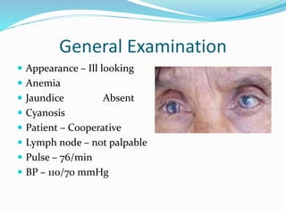 Stevens Johnson Syndrome | PPT