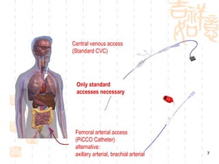 Central venous access  (Standard CVC) Femoral arterial access (PiCCO Catheter) alternative: axillary arterial, brachial arterial Only standard  accesses necessary 