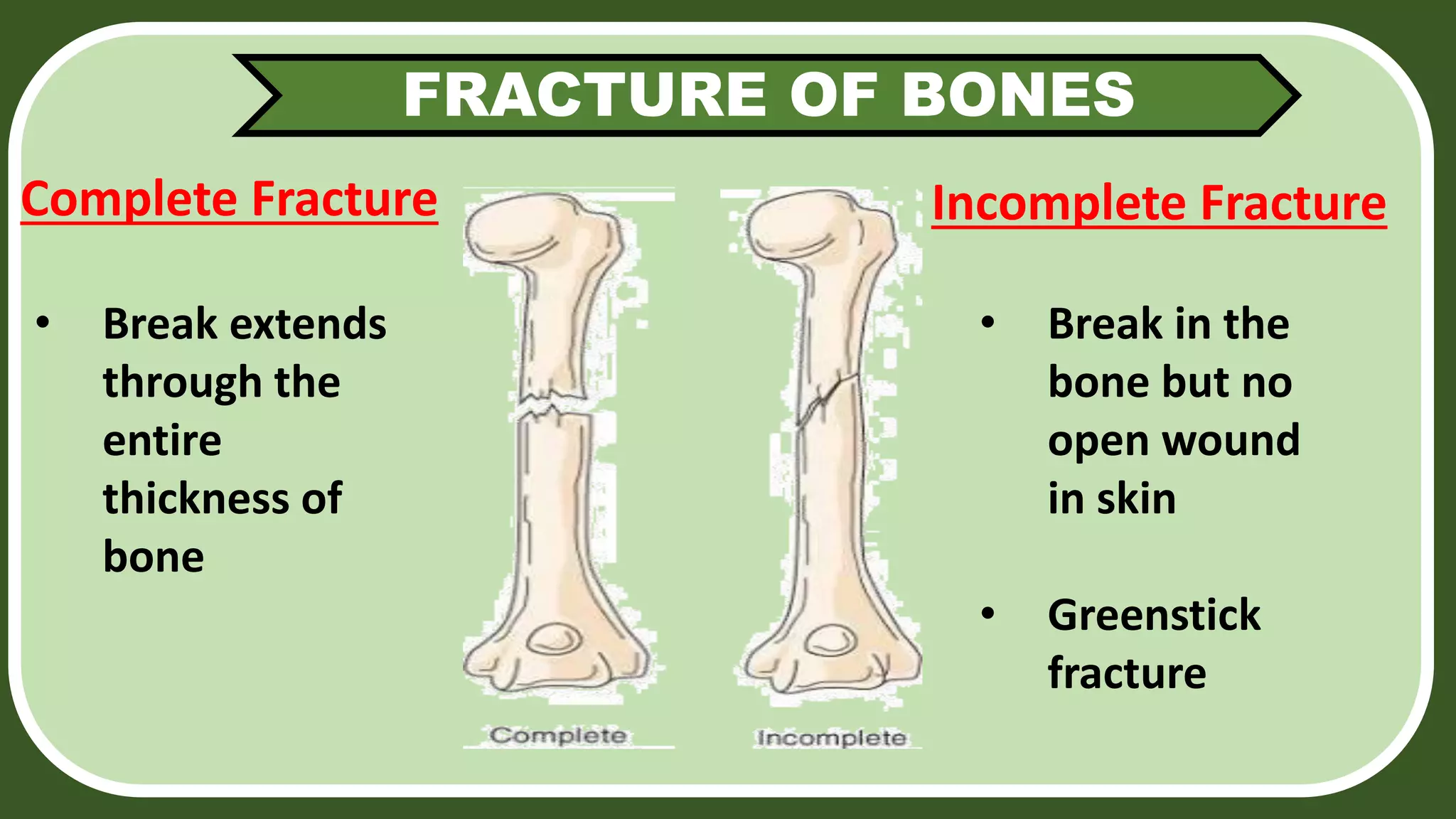 SKELETAL SYSTEM 1 pptx skeletal-system-1-pptx