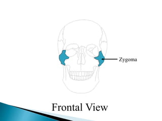 Zygoma
Frontal View
 